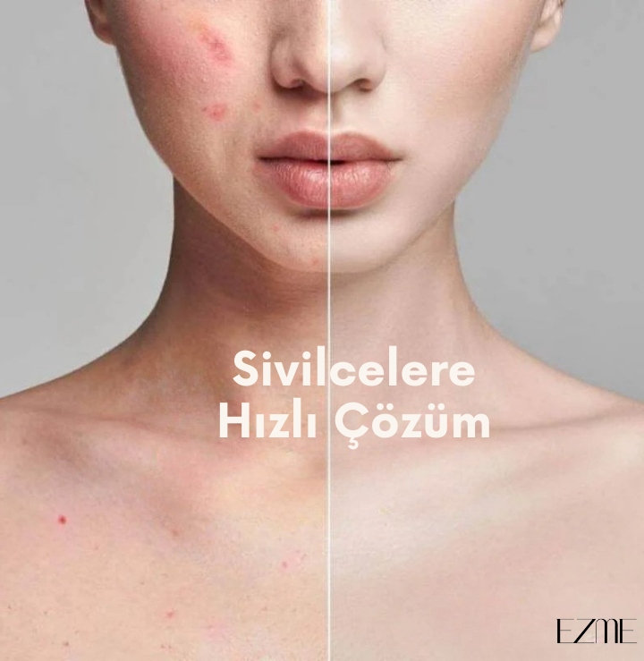 EZME  Yüksek Frekans Terapisi | Akne Temizleyici & Sivilce Önleyici