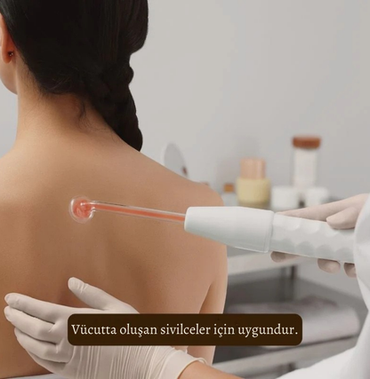 EZME  Yüksek Frekans Terapisi | Akne Temizleyici & Sivilce Önleyici