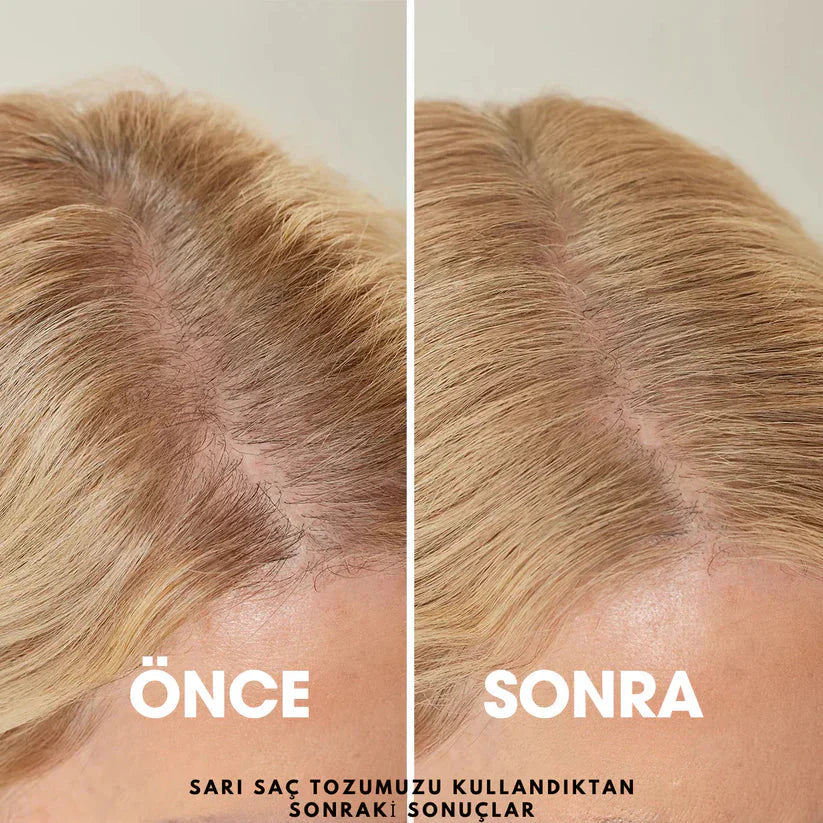 EZME™ Hairveil Saç Kökü Besleyici Kapatıcı Pudra(48 Saat Etkili Sonuç)